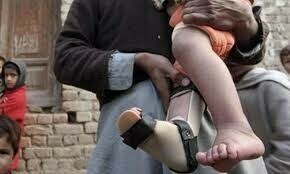 Two more polio cases reported from Karachi, Qila Abdullah - Pakistan