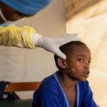 Mpox kills 548 in DR Congo this year - World